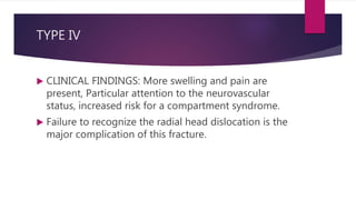 TYPE IV
 CLINICAL FINDINGS: More swelling and pain are
present, Particular attention to the neurovascular
status, increased risk for a compartment syndrome.
 Failure to recognize the radial head dislocation is the
major complication of this fracture.
 