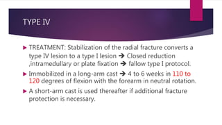 TYPE IV
 TREATMENT: Stabilization of the radial fracture converts a
type IV lesion to a type I lesion  Closed reduction
,intramedullary or plate fixation  fallow type I protocol.
 Immobilized in a long-arm cast  4 to 6 weeks in 110 to
120 degrees of flexion with the forearm in neutral rotation.
 A short-arm cast is used thereafter if additional fracture
protection is necessary.
 