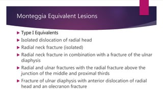 Monteggia Equivalent Lesions
 Type I Equivalents
 Isolated dislocation of radial head
 Radial neck fracture (isolated)
 Radial neck fracture in combination with a fracture of the ulnar
diaphysis
 Radial and ulnar fractures with the radial fracture above the
junction of the middle and proximal thirds
 Fracture of ulnar diaphysis with anterior dislocation of radial
head and an olecranon fracture
 