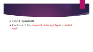  Type II Equivalents
 Fractures of the proximal radial epiphysis or radial
neck.
 