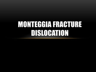 MONTEGGIA FRACTURE
DISLOCATION
 