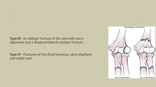 Ulna Varus Monteggia fracture dislocation siddha.pptx