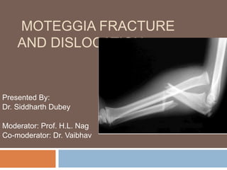 MOTEGGIA FRACTURE
AND DISLOCATION
Presented By:
Dr. Siddharth Dubey
Moderator: Prof. H.L. Nag
Co-moderator: Dr. Vaibhav
 