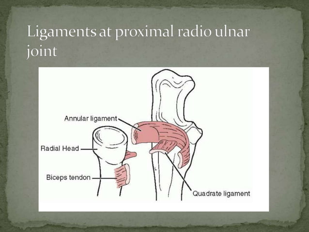 Monteggia Fracture Dislocation UTSAV PPT