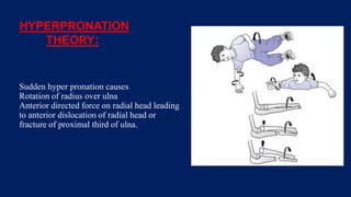 HYPERPRONATION
THEORY:
Sudden hyper pronation causes
Rotation of radius over ulna
Anterior directed force on radial head leading
to anterior dislocation of radial head or
fracture of proximal third of ulna.
 
