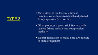 TYPE 3
• Varus stress at the level of elbow in
combination with outstretched hand planted
firmly against a fixed surface.
• Often produces a green stick fracture with
tension failure radially and compression
medially.
• Lateral dislocation of radial head a/w rupture
of annular ligament
 