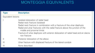 MONTEGGIA EQUIVALENTS
 