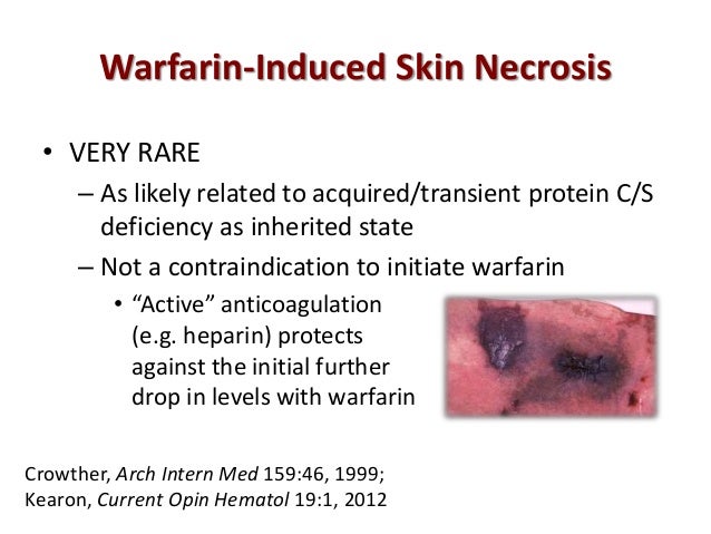 Viagra on line dove comprare