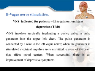 B-Vagus nerve stimulation.
VNS indicated for patients with treatment-resistant
depression (TRD)
-VNS involves surgically implanting a device called a pulse
generator into the upper left chest. The pulse generator is
connected by a wire to the left vagus nerve; when the generator is
stimulated electrical impulses are transmitted to areas of the brain
that affect mood centers. When successful, there is an
improvement of depressive symptoms.
 