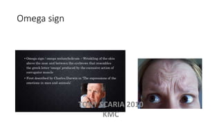 Omega sign
TONY SCARIA 2010
KMC
 