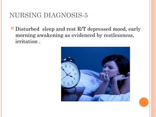 NURSING DIAGNOSIS-5
 Disturbed sleep and rest R/T depressed mood, early
morning awakening as evidenced by restlessness,
irritation .
 