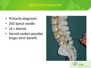 Facet Joint Injection
• Primarily diagnostic
• 25G Spinal needle
• LA + Steroid
• Steroid confers possible
longer term benefit
 