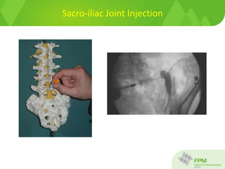 Sacro-iliac Joint Injection
 