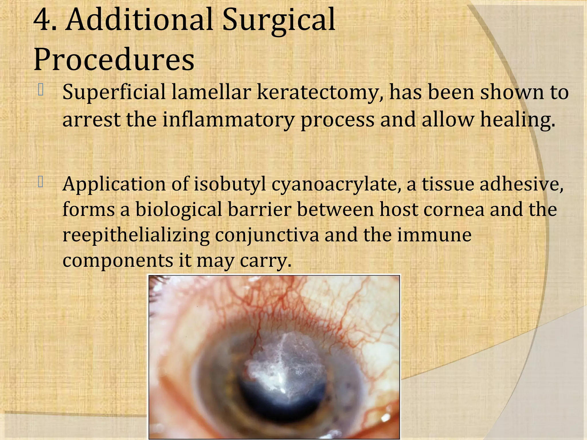 4. Additional Surgical 
Procedures 
 Superficial lamellar keratectomy, has been shown to 
arrest the inflammatory process and allow healing. 
 Application of isobutyl cyanoacrylate, a tissue adhesive, 
forms a biological barrier between host cornea and the 
reepithelializing conjunctiva and the immune 
components it may carry. 
 