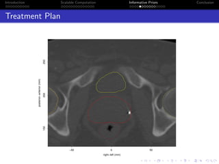 Introduction Scalable Computation Informative Priors Conclusion
Treatment Plan
−50 0 50
150200250
right−left (mm)
posterior−anterior(mm)
 