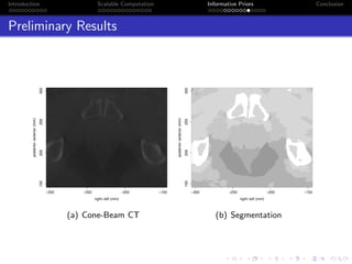 Introduction Scalable Computation Informative Priors Conclusion
Preliminary Results
−300 −250 −200 −150
150200250300
right−left (mm)
posterior−anterior(mm)
(a) Cone-Beam CT
−300 −250 −200 −150
150200250300
right−left (mm)
posterior−anterior(mm)
(b) Segmentation
 