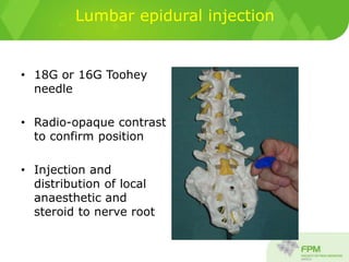 Lumbar epidural injection
• 18G or 16G Toohey
needle
• Radio-opaque contrast
to confirm position
• Injection and
distribution of local
anaesthetic and
steroid to nerve root
 