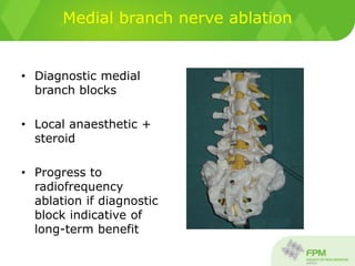 Medial branch nerve ablation
• Diagnostic medial
branch blocks
• Local anaesthetic +
steroid
• Progress to
radiofrequency
ablation if diagnostic
block indicative of
long-term benefit
 
