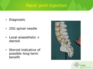 Facet joint injection
• Diagnostic
• 25G spinal needle
• Local anaesthetic +
steroid
• Steroid indicative of
possible long-term
benefit
 