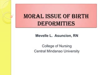 Moral Issue of Birth
   Deformities
   Mevelle L. Asuncion, RN

       College of Nursing
   Central Mindanao University
 