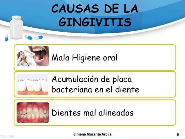 Enfermedades Periodontales