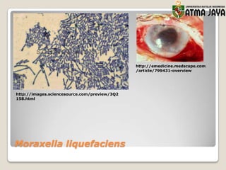 http://emedicine.medscape.com
/article/799431-overview

http://images.sciencesource.com/preview/3Q2
158.html

Moraxella liquefaciens

 