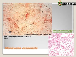 http://www.asm.org/divisi
on/c/photo/mosloen1.JPG

http://lib.jiangnan.edu.cn/ASM/0336.jpg

Moraxella olsoensis

 