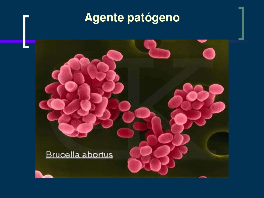 Moraxella catarrhalis