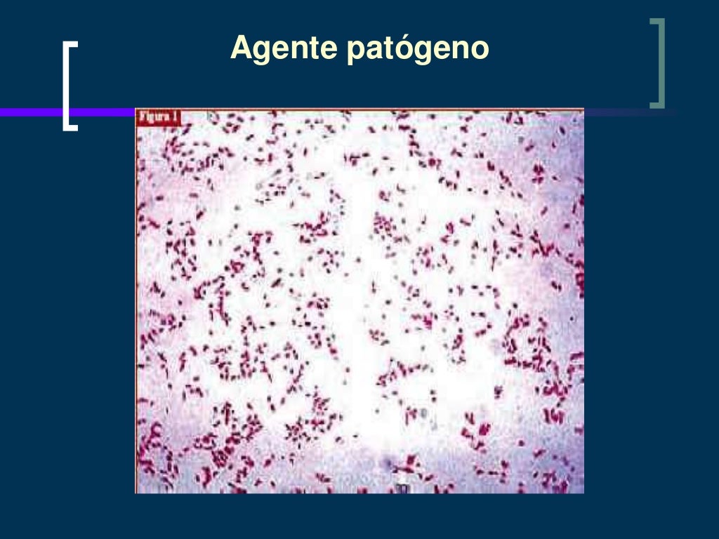 Moraxella catarrhalis