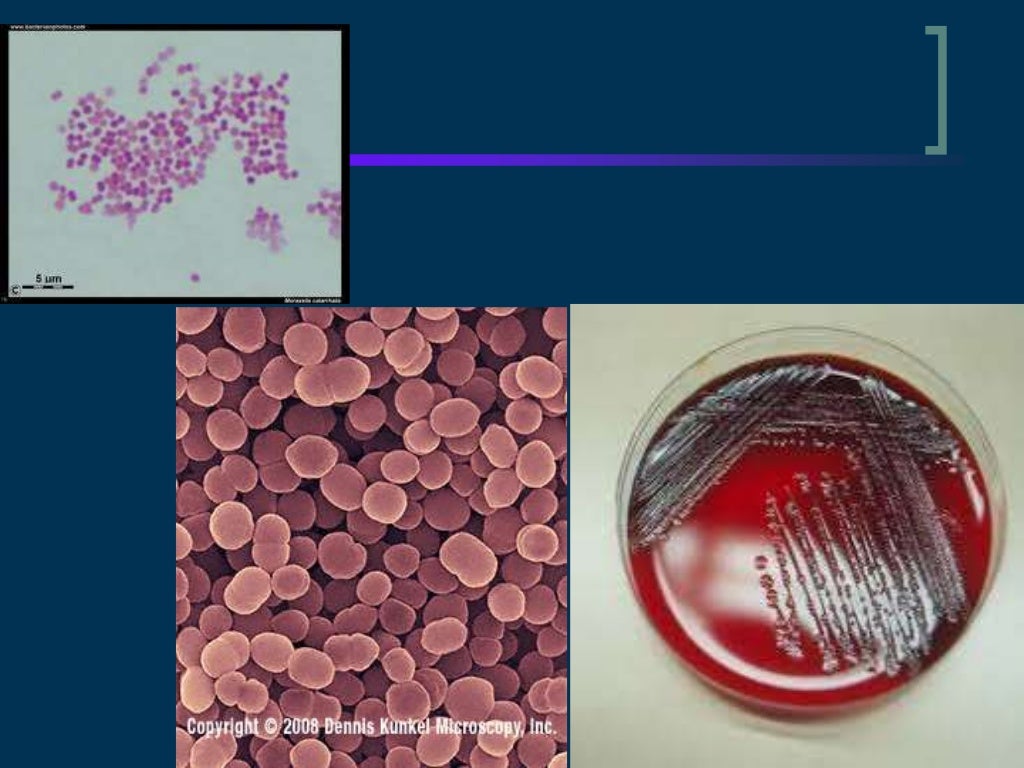 Moraxella catarrhalis