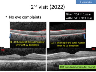 morbidity23243545565635454355434543.pptx