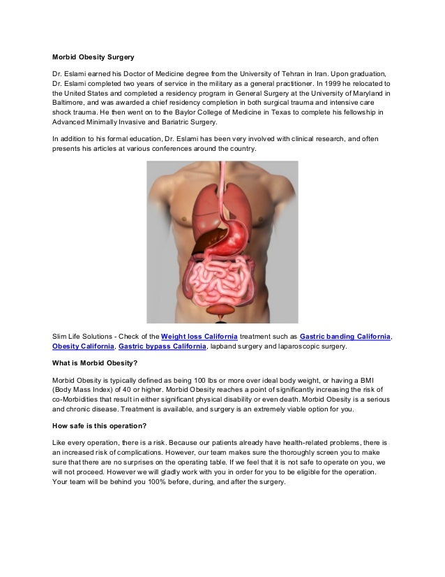 Morbid obesity surgery
