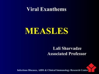 MEASLES
Lali Sharvadze
Associated Professor
Infectious Diseases, AIDS & Clinical Immunology Research Center
Viral Exanthems
 