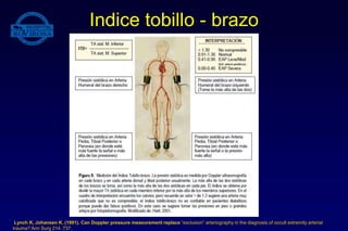 Indice tobillo - brazo
Lynch K, Johansen K. (1991). Can Doppler pressure measurement replace “exclusion” arteriography in the diagnosis of occult extremity arterial
trauma? Ann Surg 214: 737.
 