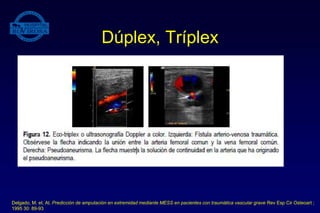 Dúplex, Tríplex
Delgado, M. et. Al. Predicción de amputación en extremidad mediante MESS en pacientes con traumática vascular grave Rev Esp Cir Osteoart ;
1995 30: 89-93
 
