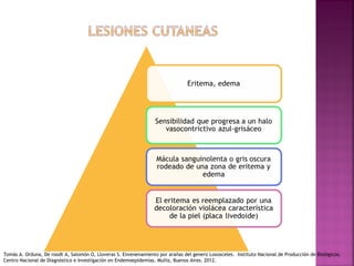 Tomás A. Orduna, De roodt A, Salomón O, Lloveras S. Envenenamiento por arañas del genero Loxosceles. Instituto Nacional de Producción de Biológicos.
Centro Nacional de Diagnóstico e Investigación en Endemoepidemias. Muñiz, Buenos Aires. 2012.
 