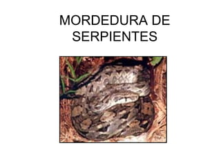 MORDEDURA DE
 SERPIENTES
 