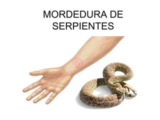 MORDEDURA DE
SERPIENTES
 