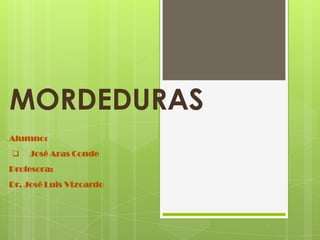 MORDEDURAS
Alumno:
 José Aras Conde
Profesora:
Dr. José Luis Vizcardo
 