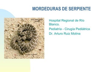 MORDEDURAS DE SERPIENTE
Hospital Regional de Río
Blanco.
Pediatría - Cirugía Pediátrica
Dr. Arturo Ruiz Molina

 