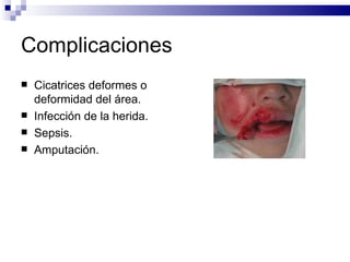 Complicaciones  Cicatrices deformes o deformidad del área. Infección de la herida. Sepsis. Amputación. 