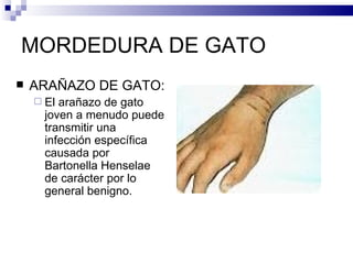 MORDEDURA DE GATO ARAÑAZO DE GATO: El arañazo de gato joven a menudo puede transmitir una infección específica causada por Bartonella Henselae de carácter por lo general benigno. 