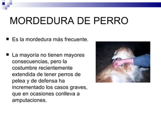 MORDEDURA DE PERRO Es la mordedura más frecuente. La mayoría no tienen mayores consecuencias, pero la costumbre recientemente extendida de tener perros de pelea y de defensa ha incrementado los casos graves, que en ocasiones conlleva a amputaciones. 