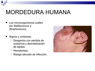 MORDEDURA HUMANA Los microorganismos suelen ser Stafilococcus y Streptococcus. Signos y síntomas: Desgarros con pérdida de sustancia y desvitalización de tejidos. Hematomas. Riesgo elevado de infección. 