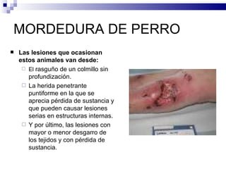 MORDEDURA DE PERRO Las lesiones que ocasionan estos animales van desde: El  rasguño de un colmillo sin profundización. La herida penetrante puntiforme en la que se aprecia pérdida de sustancia y que pueden causar lesiones serias en estructuras internas. Y por último, las lesiones con mayor o menor desgarro de los tejidos y con pérdida de sustancia. 