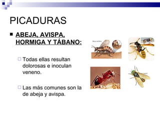 PICADURAS ABEJA, AVISPA, HORMIGA Y TÁBANO: Todas ellas resultan dolorosas e inoculan veneno. Las más comunes son la de abeja y avispa. 