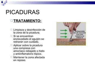 PICADURAS TRATAMIENTO: Limpieza y desinfección de la zona de la picadura. Si se encuentran enclavadado el aguijón se retirarán con cuidado. Aplicar sobre la picadura una compresa con amoniaco rebajado o hielo y antiinflamatorio tópico. Mantener la zona afectada en reposo. 