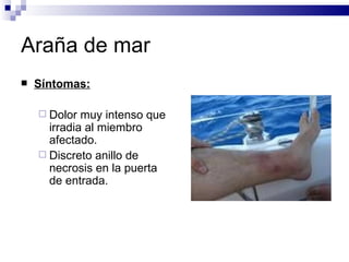 Araña de mar Síntomas: Dolor muy intenso que irradia al miembro afectado. Discreto anillo de necrosis en la puerta de entrada. 