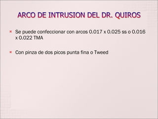 Se puede confeccionar con arcos 0.017 x 0.025 ss o 0.016 x 0.022 TMA Con pinza de dos picos punta fina o Tweed 