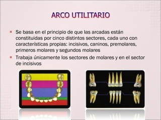 Se basa en el principio de que las arcadas están constituidas por cinco distintos sectores, cada uno con características propias: incisivos, caninos, premolares, primeros molares y segundos molares Trabaja únicamente los sectores de molares y en el sector de incisivos 